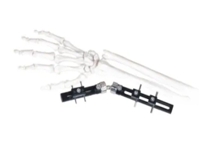 Straight Pin Type Wrist Medical External Fixator minimal interference