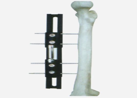 Medical External Fixator of bone lengthening, light and easy to do the operation