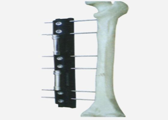 Medical External Fixator of bone lengthening, light and easy to do the operation