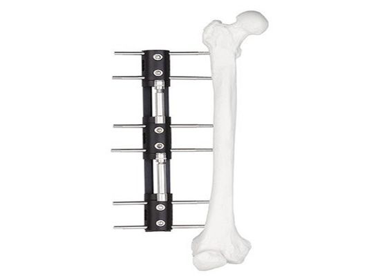 Medical External Fixator of bone lengthening, light and easy to do the operation