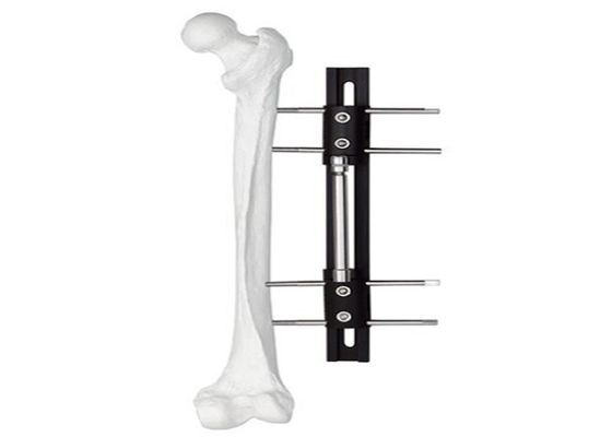 Medical External Fixator of bone lengthening, light and easy to do the operation