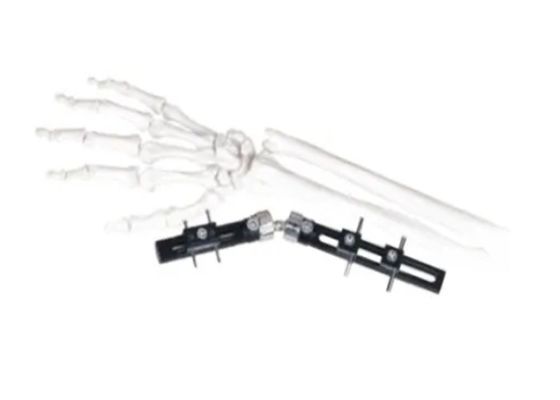 Straight Pin Type Wrist Medical External Fixator minimal interference with soft-tissue