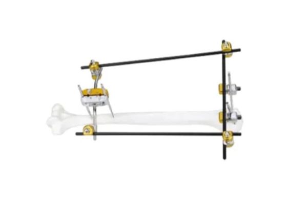 Proximal Humerus Medical External Fixator